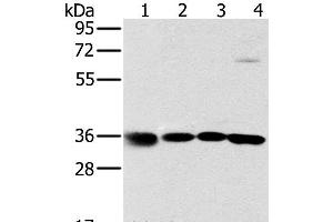 MRPL39 anticorps