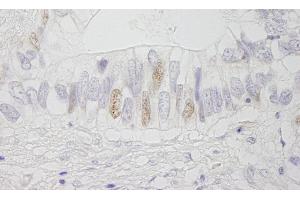 Immunohistochemistry (IHC) image for anti-Adenomatous Polyposis Coli (APC) (AA 1-50) antibody (ABIN7448412) (APC antibody  (AA 1-50))