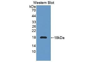 Western Blotting (WB) image for anti-Interleukin 6 Receptor (IL6R) (AA 52-204) antibody (ABIN1859439) (IL-6 Receptor antibody  (AA 52-204))