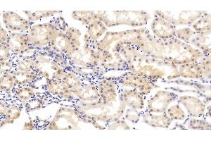 Detection of CASP6 in Bovine Kidney Tissue using Polyclonal Antibody to Caspase 6 (CASP6) (Caspase 6 antibody  (AA 81-179))