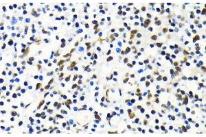 Immunohistochemistry of paraffin-embedded Human tonsil using MKL1 Polyclonal Antibody at dilution of 1:100 (40x lens). (MKL1 antibody)