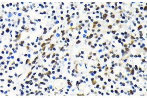 Immunohistochemistry of paraffin-embedded Human tonsil using MKL1 Polyclonal Antibody at dilution of 1:100 (40x lens).