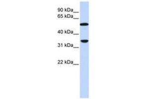 Image no. 1 for anti-Complement Component C4b (C4b) (AA 144-193) antibody (ABIN6743078) (C4B antibody  (AA 144-193))