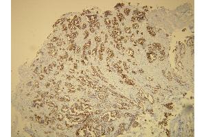Immunohistochemistry (IHC) image for anti-Keratin 7 (KRT7) (AA 22-38), (N-Term) antibody (ABIN870438) (Cytokeratin 7 antibody  (N-Term))