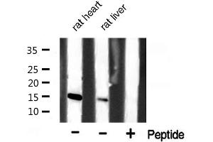 Western blot analysis of extracts of various celllines,using p15 INK Antibody. (CDKN2B antibody  (Internal Region))