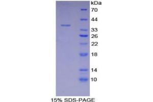 SDS-PAGE (SDS) image for Lactate Dehydrogenase A (LDHA) (AA 1-332) protein (His tag) (ABIN1080190) (Lactate Dehydrogenase A Protein (LDHA) (AA 1-332) (His tag))