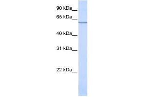 SLC1A1 antibody used at 1 ug/ml to detect target protein. (SLC1A1 antibody  (N-Term))