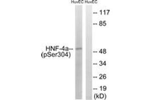 Western blot analysis of extracts from HuvEc cells treated with EGF 200ng/ml 30', using HNF4 alpha (Phospho-Ser313) Antibody. (HNF4A antibody  (pSer313))