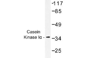 Image no. 1 for anti-Casein Kinase 1, alpha 1 (CSNK1A1) antibody (ABIN272195) (CSNK1A1 antibody)