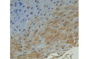 IHC-P analysis of Human Tissue, with DAB staining. (Cyclin B2 antibody  (AA 58-398))