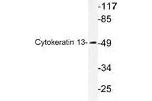 Western blot analysis of Cytokeratin 13 antibody in extracts from HepG2 cells. (Cytokeratin 13 antibody)