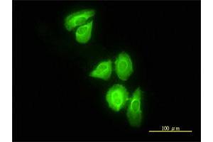 Immunofluorescence of monoclonal antibody to DNAJC3 on HeLa cell. (DNAJC3 antibody  (AA 1-234))