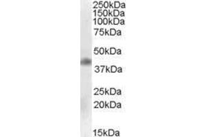 Western Blotting (WB) image for anti-Meis Homeobox 1 (MEIS1) antibody (ABIN5871084) (MEIS1 antibody)