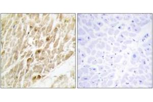 Immunohistochemistry (IHC) image for anti-Core-Binding Factor, beta Subunit (CBFB) (AA 11-60) antibody (ABIN1533882)