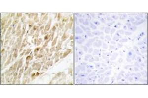 Immunohistochemistry analysis of paraffin-embedded human heart tissue, using CBF beta Antibody. (CBFB antibody  (AA 11-60))