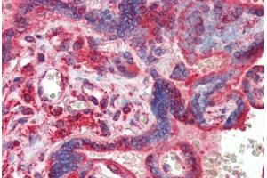 Human Placenta (formalin-fixed, paraffin-embedded) stained with ATF4 antibody ABIN462203 followed by biotinylated goat anti-rabbit IgG secondary antibody ABIN481713, alkaline phosphatase-streptavidin and chromogen. (ATF4 antibody  (N-Term))
