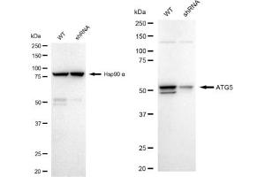 Western blotting analysis using ATG5 antibody (ABIN7797674). (Recombinant ATG5 antibody)