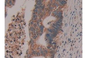 Immunohistochemistry (IHC) image for anti-Cytochrome C, Somatic (CYCS) (AA 5-100) antibody (ABIN7442270)