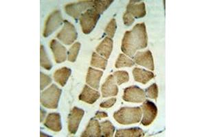 Immunohistochemistry analysis in formalin fixed and paraffin embedded human skeletal muscle tissue reacted with PARVA Antibody (C-term) Cat. (Parvin alpha antibody  (C-Term))