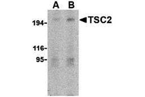 Western Blotting (WB) image for anti-Tuberous Sclerosis 2 (TSC2) (N-Term) antibody (ABIN1031646) (Tuberin antibody  (N-Term))