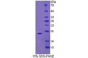SDS-PAGE of Protein Standard from the Kit  (Highly purified E. (RALBP1 ELISA Kit)