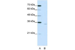 CPEB2 antibody used at 1. (CPEB2 antibody  (Middle Region))