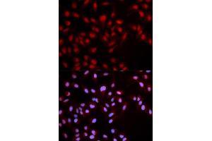 Immunofluorescence analysis of U2OS cell using Phospho-MET-Y1349 antibody. (c-MET antibody  (pTyr1349))