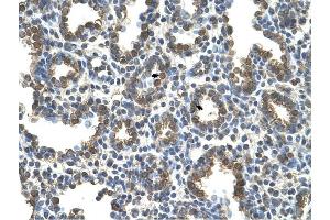SLC37A3 antibody was used for immunohistochemistry at a concentration of 4-8 ug/ml to stain Alveolar cells (arrows) in Human Lung.