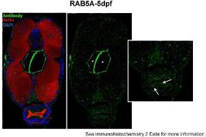 Sample type: zebra gut epithelial cellsGreen: primaryRed: actinBlue: DAPIPrimary dilution: 1:5000Secondary Dilution: 1:300Image Submitted by: Michel BagnatDuke University Medical Center . (RAB5 antibody  (Middle Region))