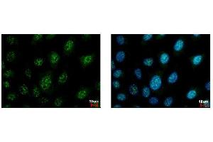 Immunofluorescence (IF) image for anti-Bridging Integrator 1 (BIN1) antibody (ABIN2855595)