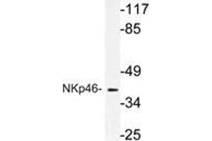 Western blot (WB) analysis of NKp46 antibody in extracts from A549 cells. (NCR1 antibody)