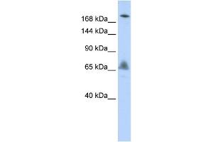 WB Suggested Anti-VPS8 Antibody Titration:  0. (VPS8 antibody  (N-Term))