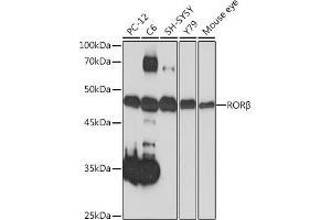 Western blot analysis of extracts of various cell lines, using RORβ Rabbit mAb (ABIN7269855) at 1:1000 dilution. (RORB antibody)