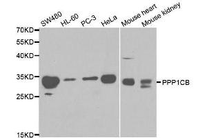 Western blot analysis of extracts of various cell lines, using PPP1CB antibody. (PPP1CB antibody  (AA 1-327))