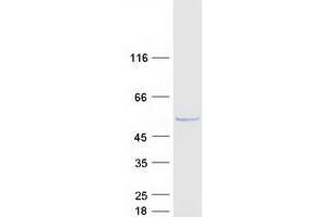 Dihydrouridine Synthase 1-Like (DUS1L) protein (Myc-DYKDDDDK Tag)