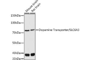 Western blot analysis of extracts of various cell lines, using Dopamine Transporter/SLC6 antibody (ABIN7270474) at 1:1000 dilution.