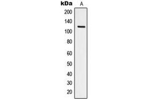 Western blot analysis of Focal Adhesion Kinase (pY925) expression in NIH3T3 pervanadate-treated (A) whole cell lysates. (FAK antibody  (C-Term, pTyr925))