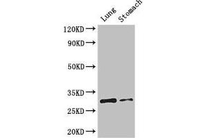 Western Blot Positive WB detected in: Mouse lung tissue, Mouse stomach tissue All lanes: TNFRSF5 antibody at 3. (CD4 antibody  (AA 21-193))