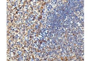 IHC analysis of ICAM1 using anti-ICAM1 antibody (ABIN7601066). (ICAM1 antibody  (AA 28-268))