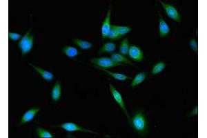 Immunofluorescent analysis of Hela cells using ABIN7154428 at dilution of 1:100 and Alexa Fluor 488-congugated AffiniPure Goat Anti-Rabbit IgG(H+L) (FAM59A antibody  (AA 12-320))