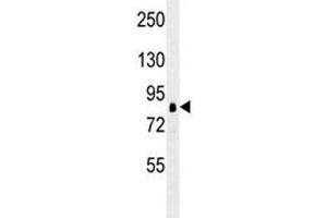 Western Blotting (WB) image for anti-Ribosomal Protein S6 Kinase, 90kDa, Polypeptide 1 (RPS6KA1) antibody (ABIN3032487)