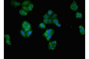 Immunofluorescent analysis of HepG2 cells using ABIN7151747 at dilution of 1:100 and Alexa Fluor 488-congugated AffiniPure Goat Anti-Rabbit IgG(H+L) (EPAS1 antibody  (AA 543-870))