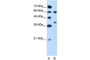 Arginase 1 antibody used at 5 ug/ml to detect target protein. (Liver Arginase antibody  (Arg1, N-Term))