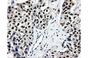 Immunohistochemical staining of paraffin-embedded Kidney tissue using anti-CISD1mouse monoclonal antibody. (CISD1 antibody)