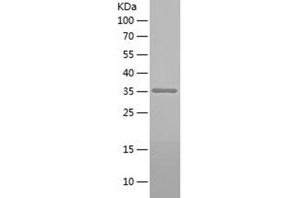 SNRPN Protein (AA 165-294) (His-IF2DI Tag)