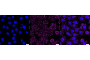 Immunocytochemical staining of HT- cells with Ribophorin I antibody (ABIN7800214), 1:1,000). (Recombinant RPN1 antibody)
