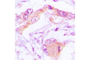 Immunohistochemical analysis of MRPL13 staining in human lung formalin fixed paraffin embedded tissue section. (MRPL13 antibody  (C-Term))