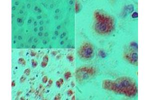 Image no. 1 for anti-Dachshund 1 (DACH1) (AA 474-491) antibody (ABIN960126) (DACH1 antibody  (AA 474-491))