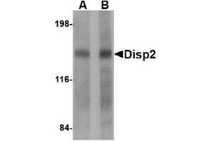 Western blot analysis of Disp2 in rat brain tissue lysate with AP30293PU-N Disp2 antibody at (A) 1 and (B) 2 μg/ml. (DISP2 antibody  (C-Term))