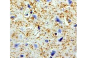 Used in DAB staining on fromalin fixed paraffin-embedded Brain tissue (PNOC antibody  (AA 20-176))